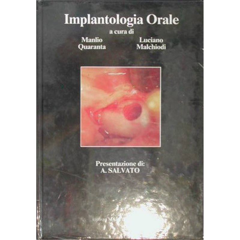 Implantologia orale